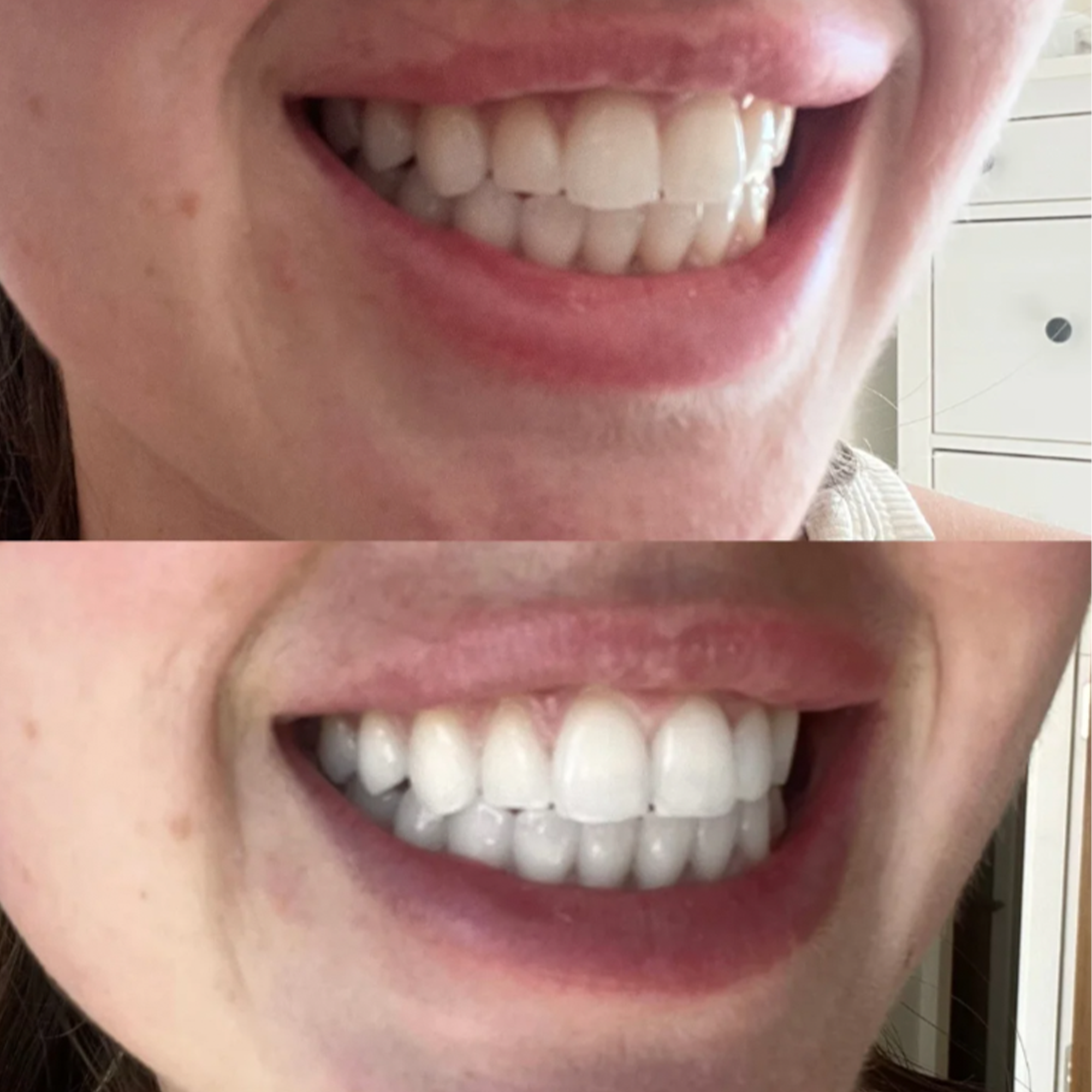 before-and-after-1.png__PID:39e47f18-c3f5-4dd3-a647-df05b3a1016e
