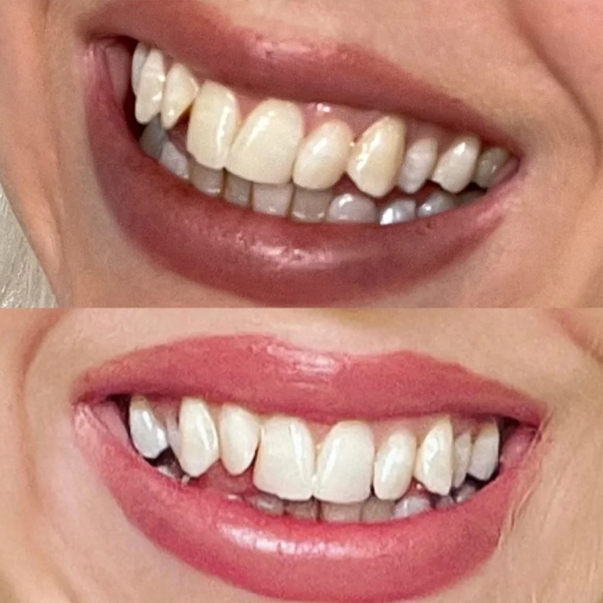 before-and-after-2.png__PID:e47f18c3-f54d-43a6-87df-05b3a1016ef6