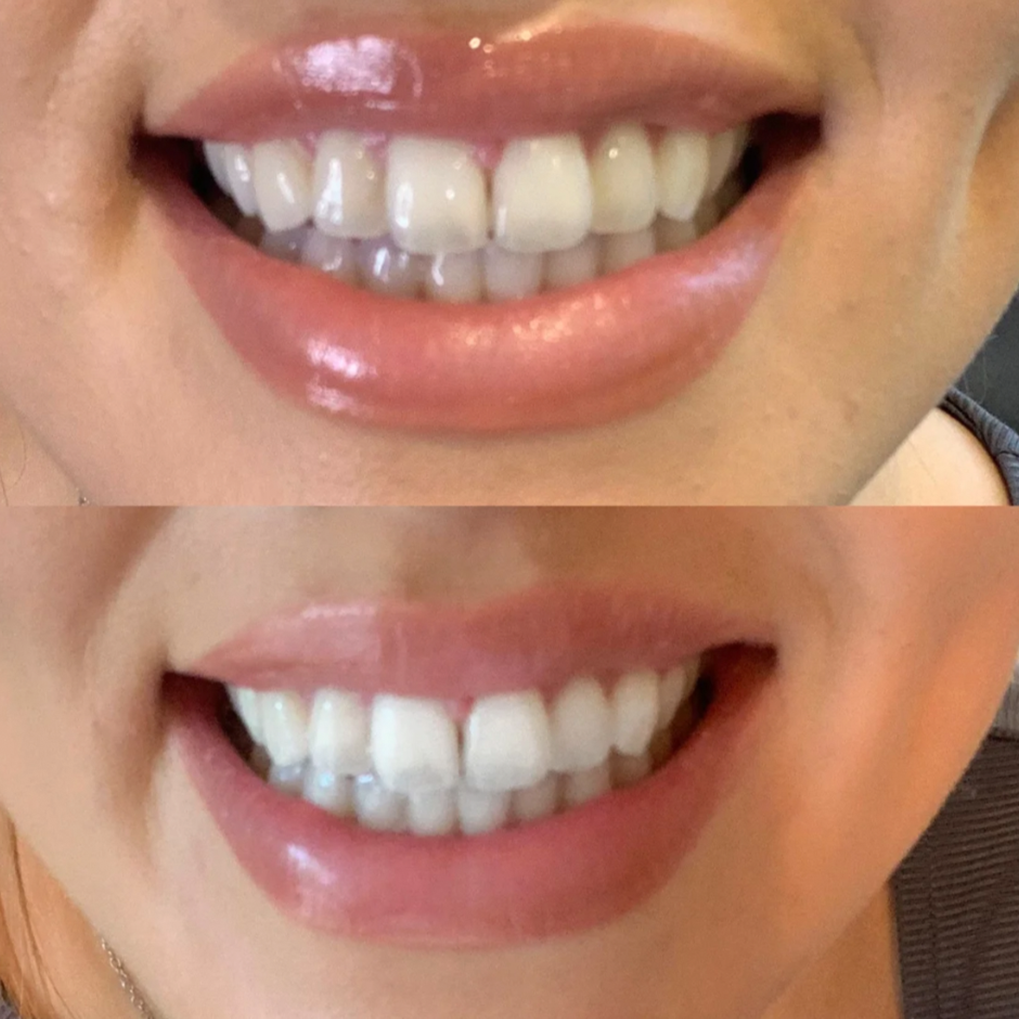 before-and-after-4.png__PID:7f18c3f5-4dd3-4647-9f05-b3a1016ef650
