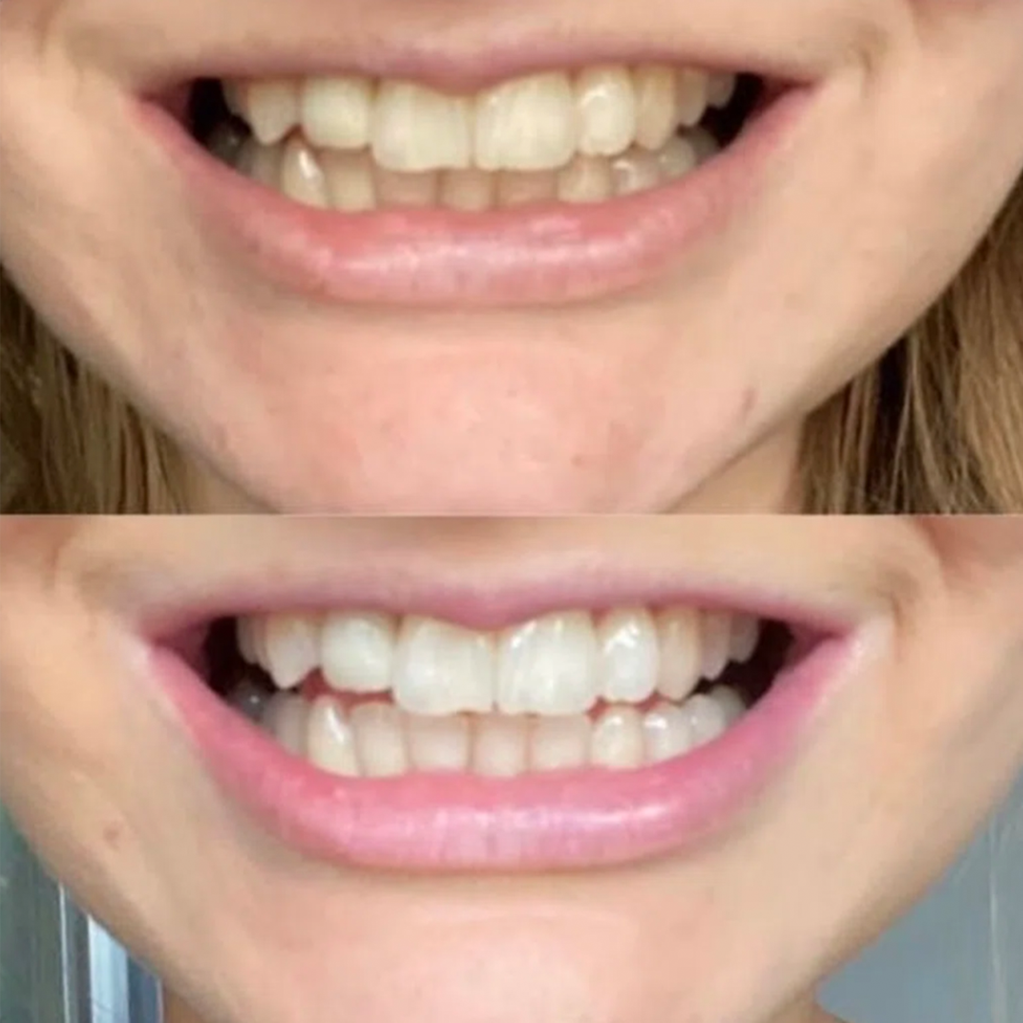 before-and-after-5.png__PID:18c3f54d-d3a6-47df-85b3-a1016ef650b9